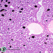 Frog liver under the compound student microscope. Frog Liver Under the Microscope