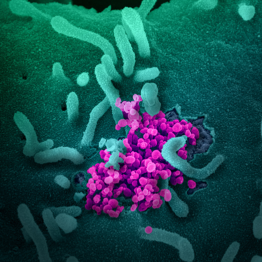 Scanning Electron Image of Coronavirus that causes COVID-19.